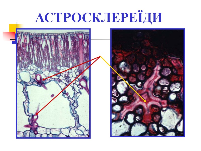 АСТРОСКЛЕРЕЇДИ